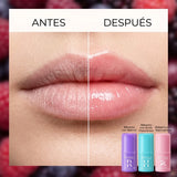 Antes y despues: labios mas llenos y suaves con LipLift 3D